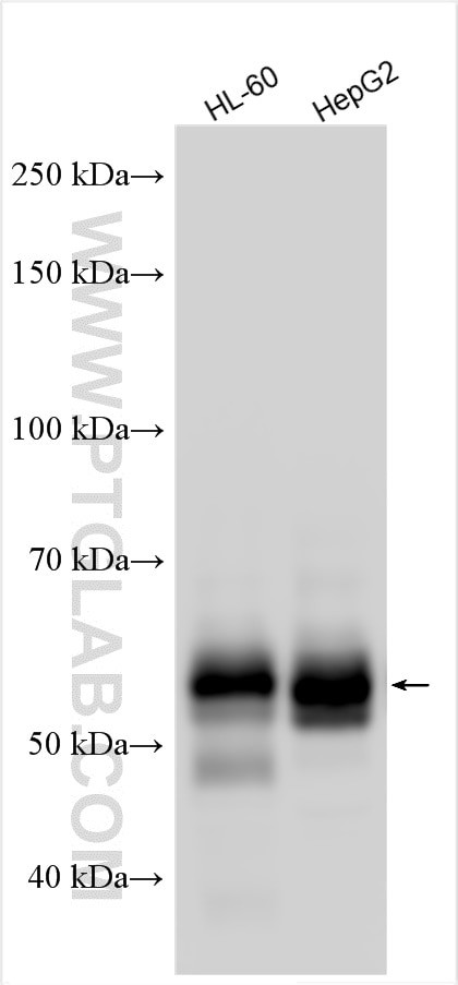 ZFP36L2 Antibody in Western Blot (WB)
