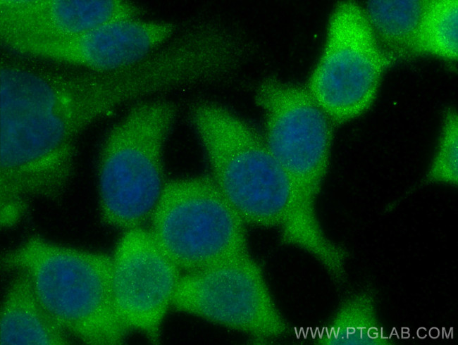 PYCARD Antibody in Immunocytochemistry (ICC/IF)