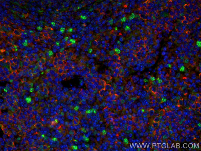 CTLA-4 Antibody in Immunohistochemistry (PFA fixed) (IHC (PFA))