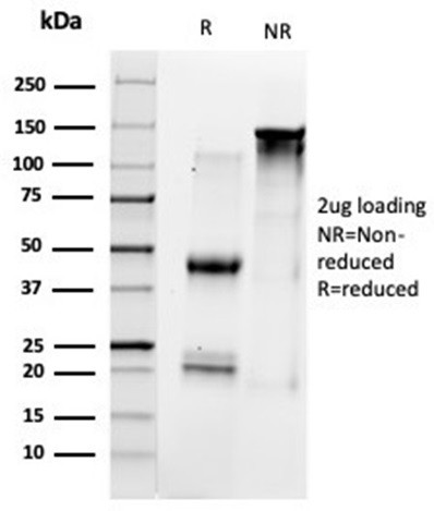 Histone Deacetylase 1 (HDAC1) Antibody in SDS-PAGE (SDS-PAGE)