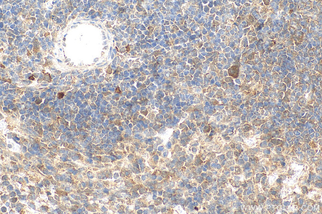 MMP25 Antibody in Immunohistochemistry (Paraffin) (IHC (P))