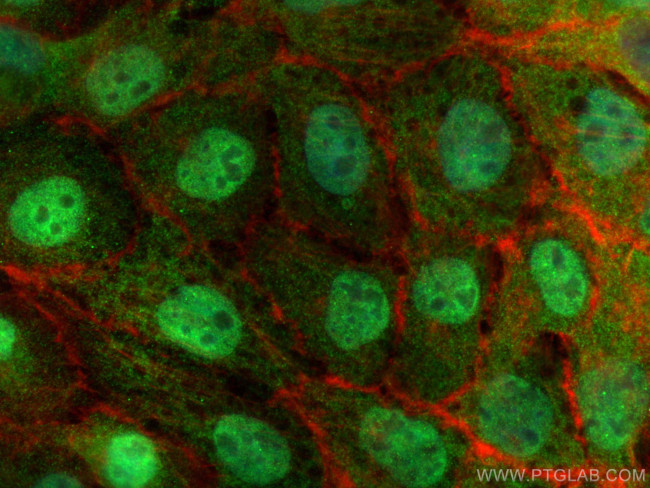 DAPK3 Antibody in Immunocytochemistry (ICC/IF)