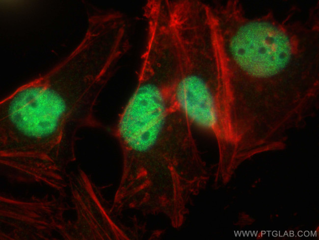 ZBTB7A Antibody in Immunocytochemistry (ICC/IF)