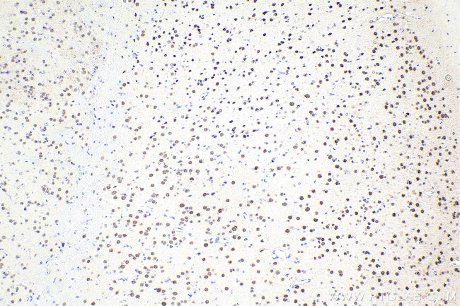 FOXK2 Antibody in Immunohistochemistry (Paraffin) (IHC (P))