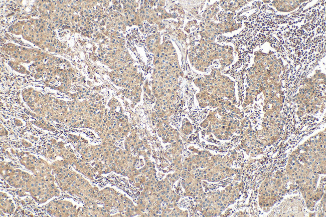 PITRM1 Antibody in Immunohistochemistry (Paraffin) (IHC (P))