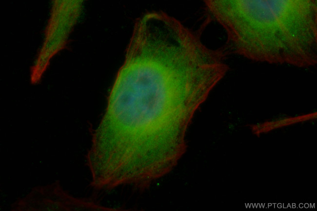 CLOCK Antibody in Immunocytochemistry (ICC/IF)