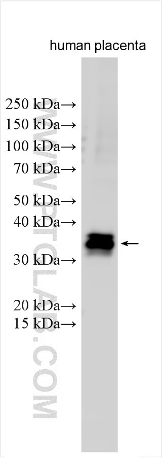 TFPI2 Antibody in Western Blot (WB)