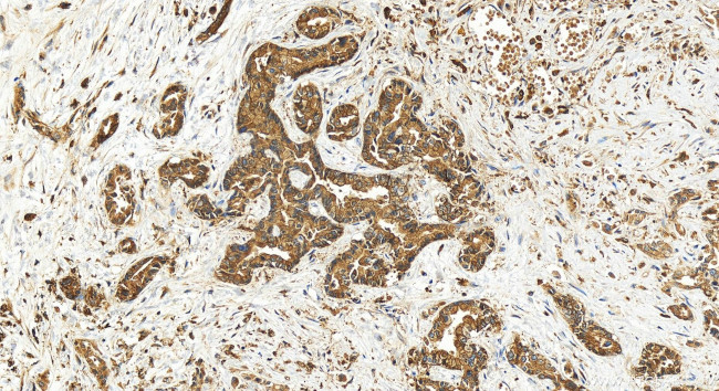 IQGAP2 Antibody in Immunohistochemistry (Paraffin) (IHC (P))
