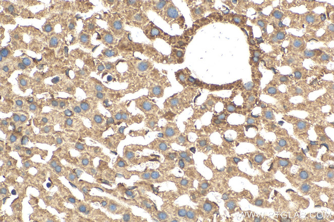 ABCC10 Antibody in Immunohistochemistry (Paraffin) (IHC (P))