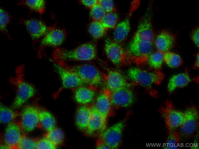 NGAL Antibody in Immunocytochemistry (ICC/IF)
