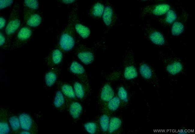 ZSCAN18 Antibody in Immunocytochemistry (ICC/IF)