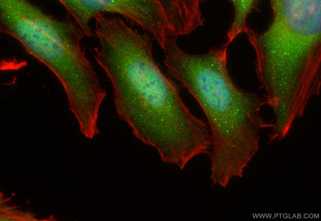 SMC2 Antibody in Immunocytochemistry (ICC/IF)