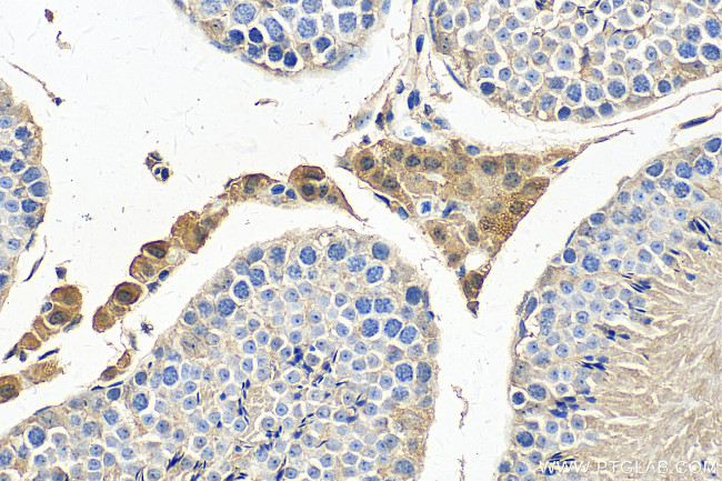 PDE8B Antibody in Immunohistochemistry (Paraffin) (IHC (P))