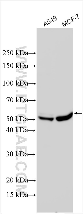ADRB3 Antibody in Western Blot (WB)