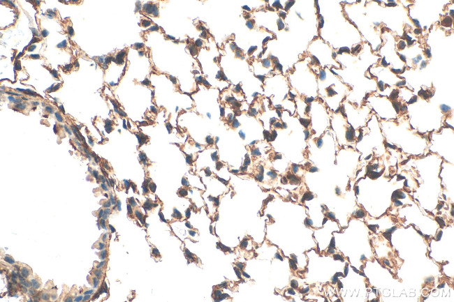 Integrin alpha-8 Antibody in Immunohistochemistry (Paraffin) (IHC (P))