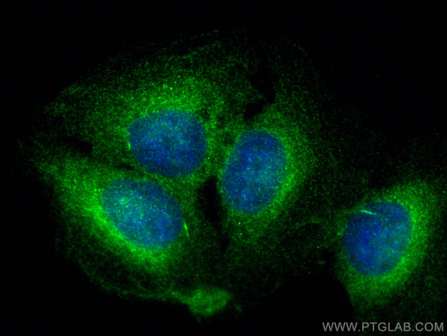 MGAT4B Antibody in Immunocytochemistry (ICC/IF)