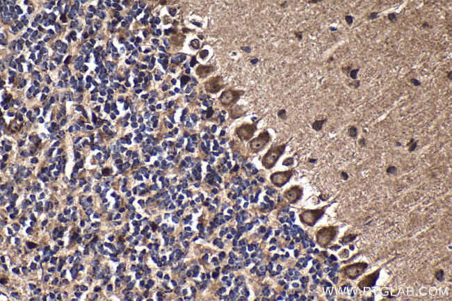 GBP3 Antibody in Immunohistochemistry (Paraffin) (IHC (P))