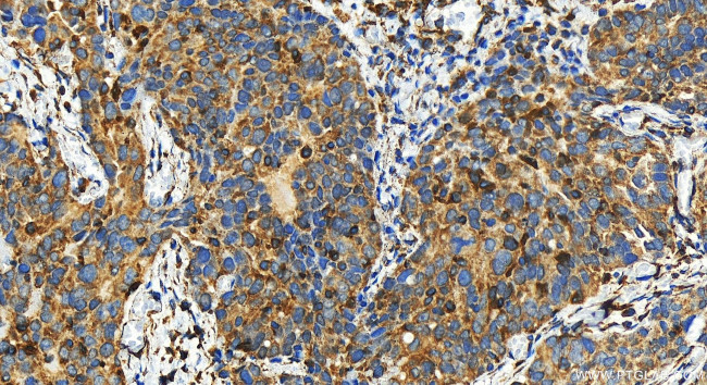 COA4 Antibody in Immunohistochemistry (Paraffin) (IHC (P))