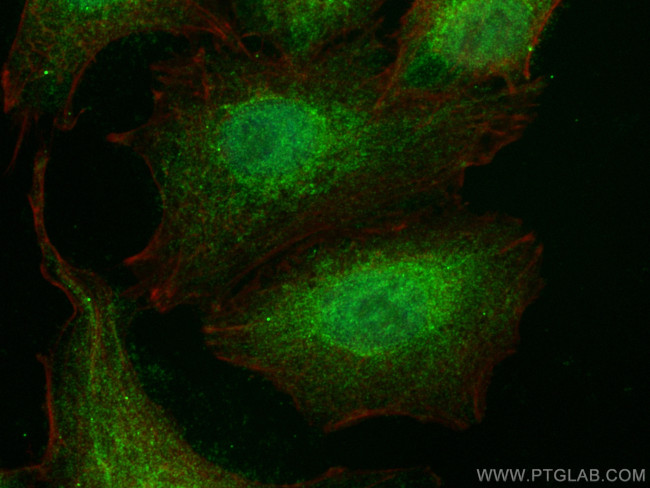 LHX8 Antibody in Immunocytochemistry (ICC/IF)