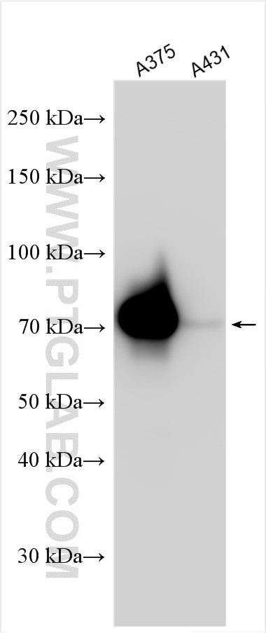 ECM1 Antibody in Western Blot (WB)