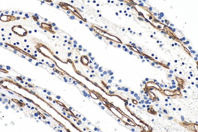 Endoglin/CD105 Antibody in Immunohistochemistry (Paraffin) (IHC (P))