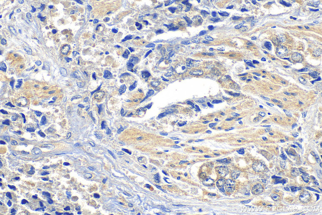 FAT1 Antibody in Immunohistochemistry (Paraffin) (IHC (P))