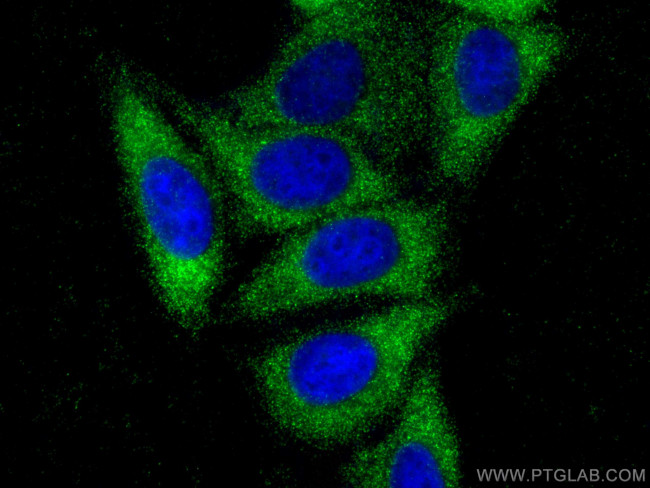 TIMP1 Antibody in Immunocytochemistry (ICC/IF)
