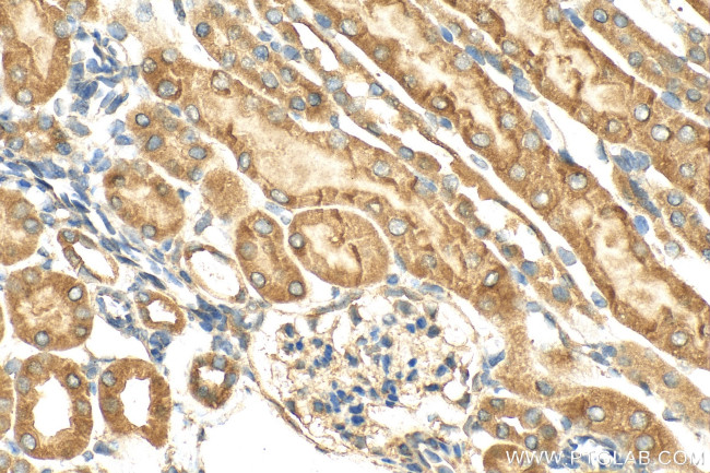 GPAT3 Antibody in Immunohistochemistry (Paraffin) (IHC (P))