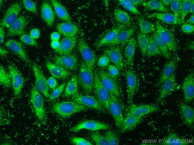 RNF31/HOIP Antibody in Immunocytochemistry (ICC/IF)