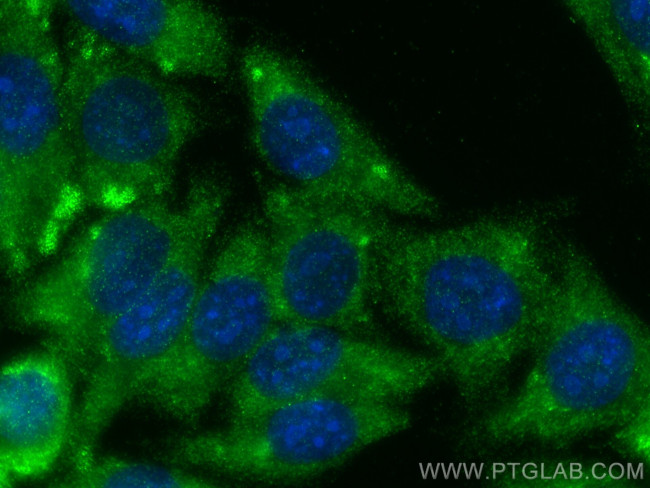 MMP1 Antibody in Immunocytochemistry (ICC/IF)