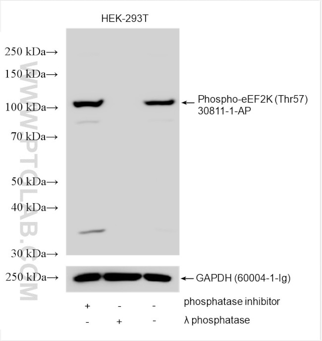 Phospho-eEF2K (Thr57) Antibody in Western Blot (WB)