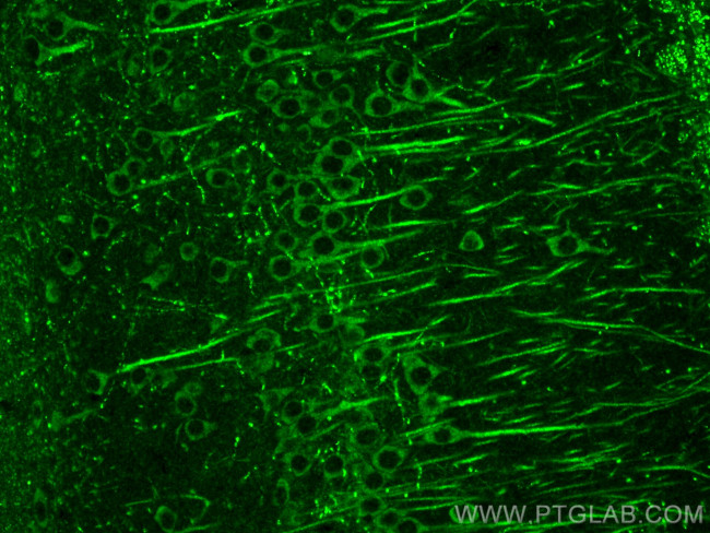 SLC6A20 Antibody in Immunohistochemistry (Paraffin) (IHC (P))