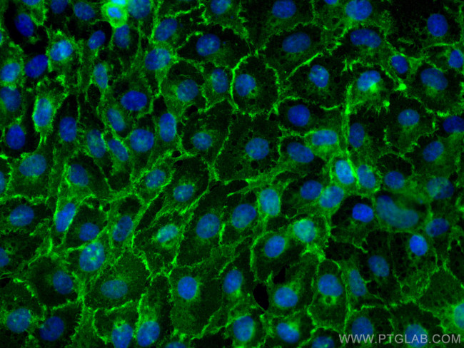 Egfr Antibody in Immunocytochemistry (ICC/IF)