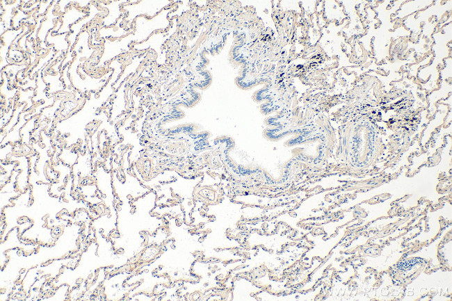 Collagen Type IV Antibody in Immunohistochemistry (Paraffin) (IHC (P))