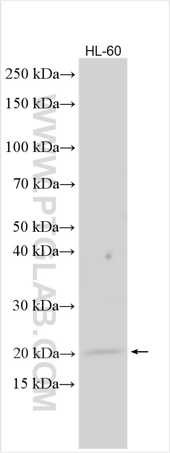 SETD4 Antibody in Western Blot (WB)