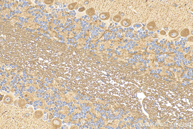 KIAA1715 Antibody in Immunohistochemistry (Paraffin) (IHC (P))