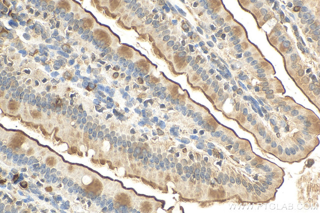 SGLT1 Antibody in Immunohistochemistry (Paraffin) (IHC (P))