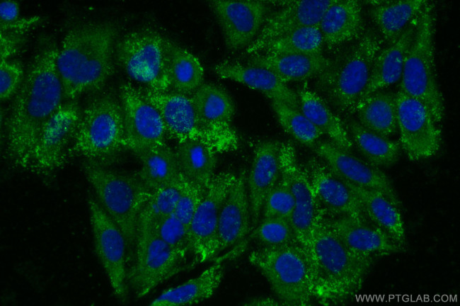 GPR52 Antibody in Immunocytochemistry (ICC/IF)