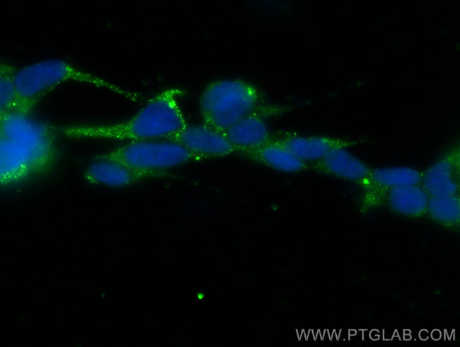 MEX3A Antibody in Immunocytochemistry (ICC/IF)