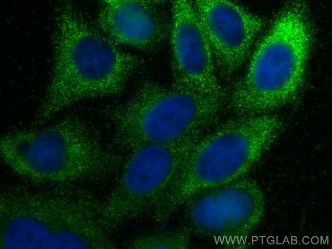 Timp1 Antibody in Immunocytochemistry (ICC/IF)