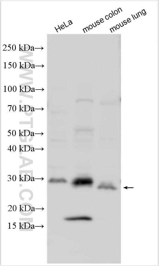 Osteoprotegerin/TNFRSF11B Antibody in Western Blot (WB)