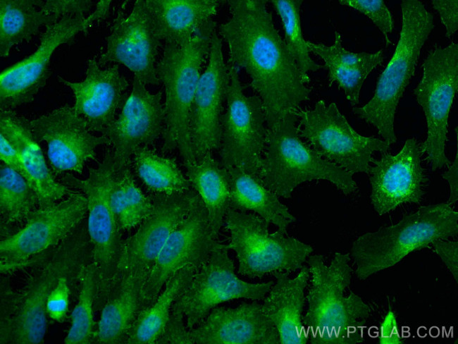 CD147 Antibody in Immunocytochemistry (ICC/IF)
