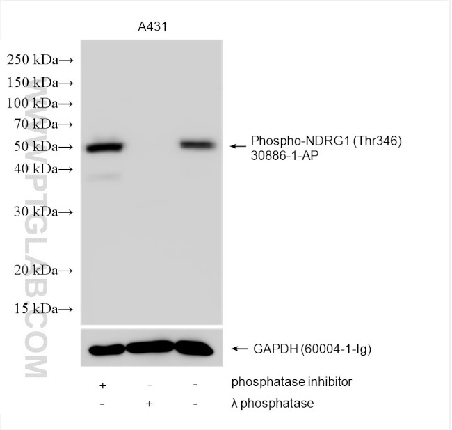 Phospho-NDRG1 (Thr346) Antibody in Western Blot (WB)