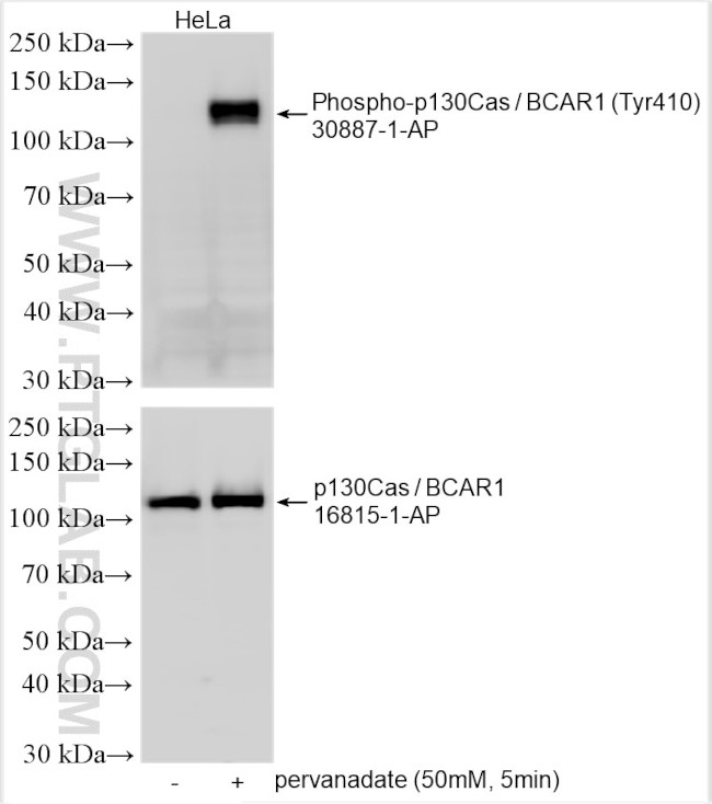 Phospho-p130Cas/BCAR1 (Tyr410) Antibody in Western Blot (WB)