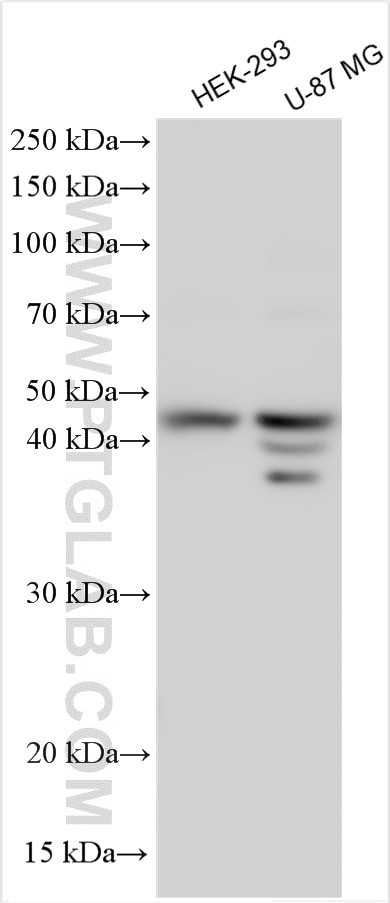 COQ2 Antibody in Western Blot (WB)