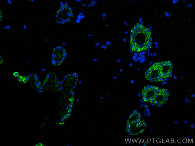 KCNJ18 Antibody in Immunohistochemistry (PFA fixed) (IHC (PFA))