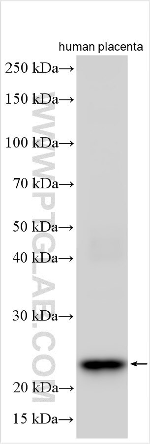 SCN4B Antibody in Western Blot (WB)