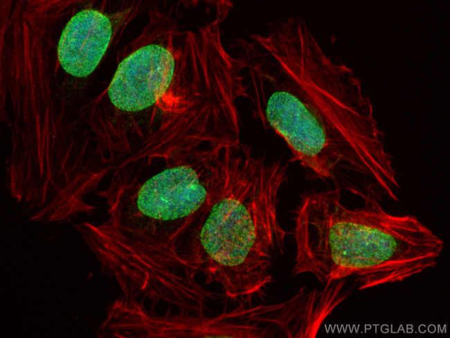 AHCTF1 Antibody in Immunocytochemistry (ICC/IF)