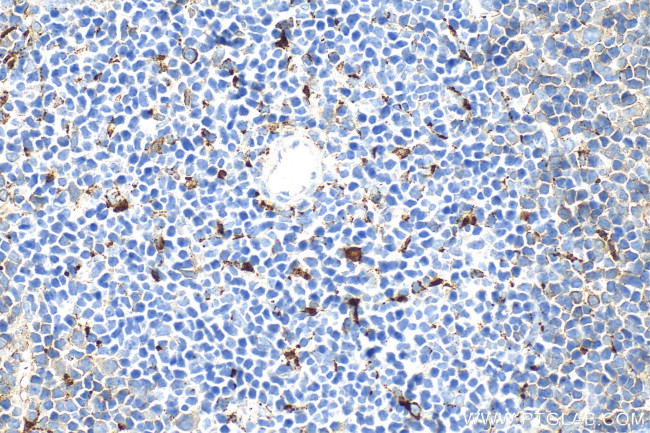 CD68 Antibody in Immunohistochemistry (Paraffin) (IHC (P))