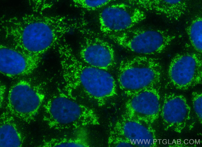 RNF180 Antibody in Immunocytochemistry (ICC/IF)